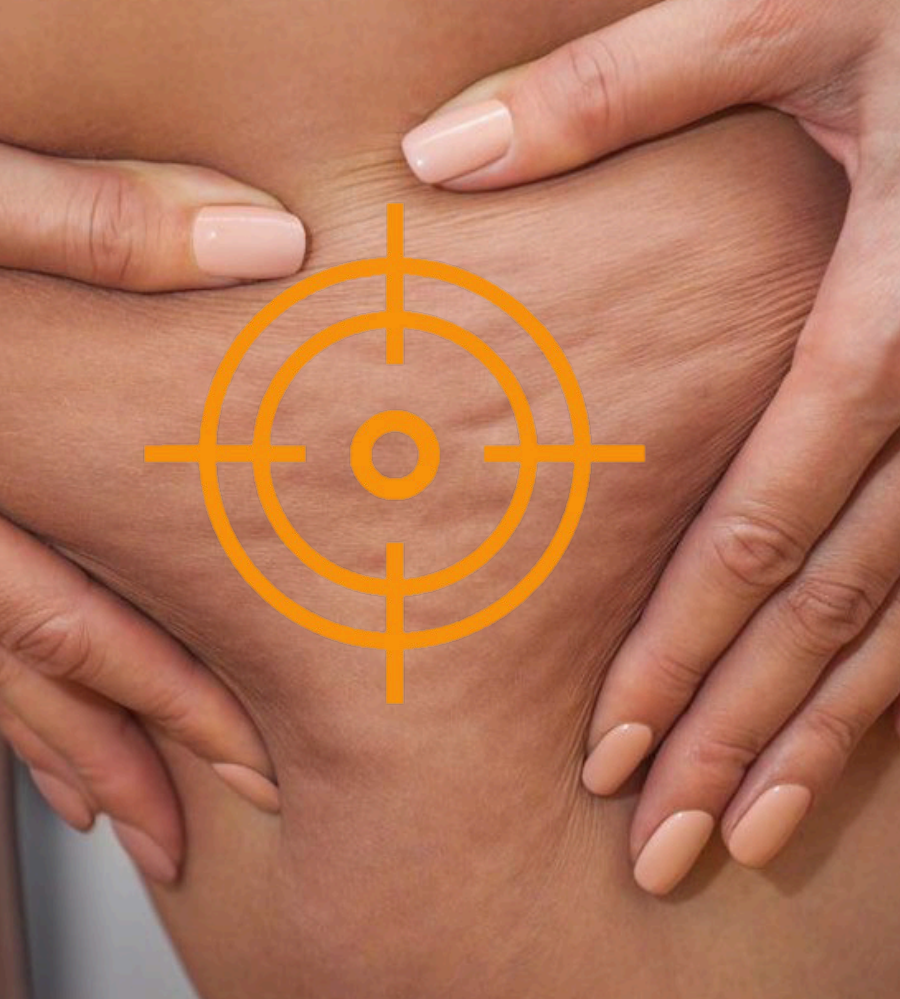 Arosha kehamähised - kellele sobib