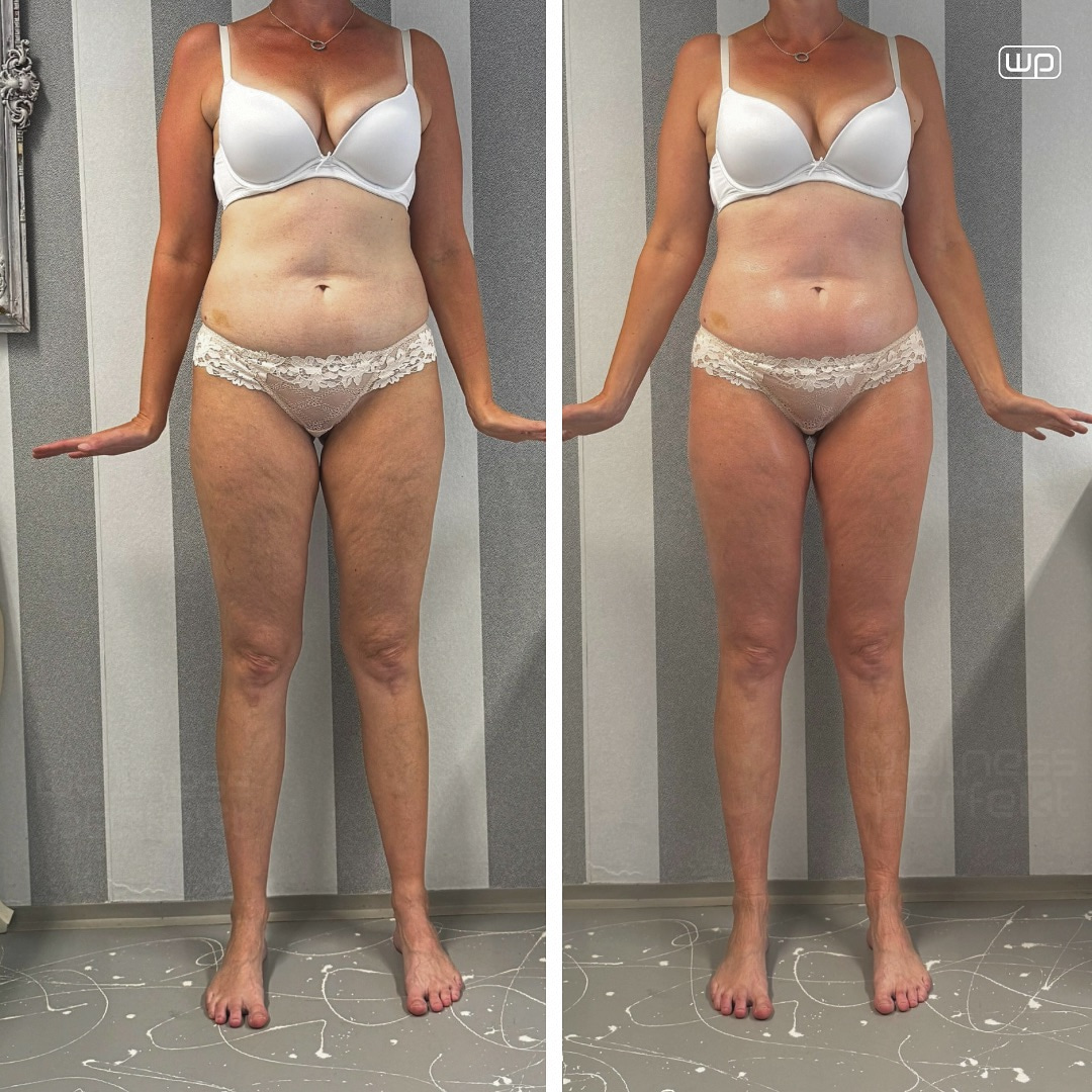 Arosha kehamähised tulemused - enne ja pärast 2