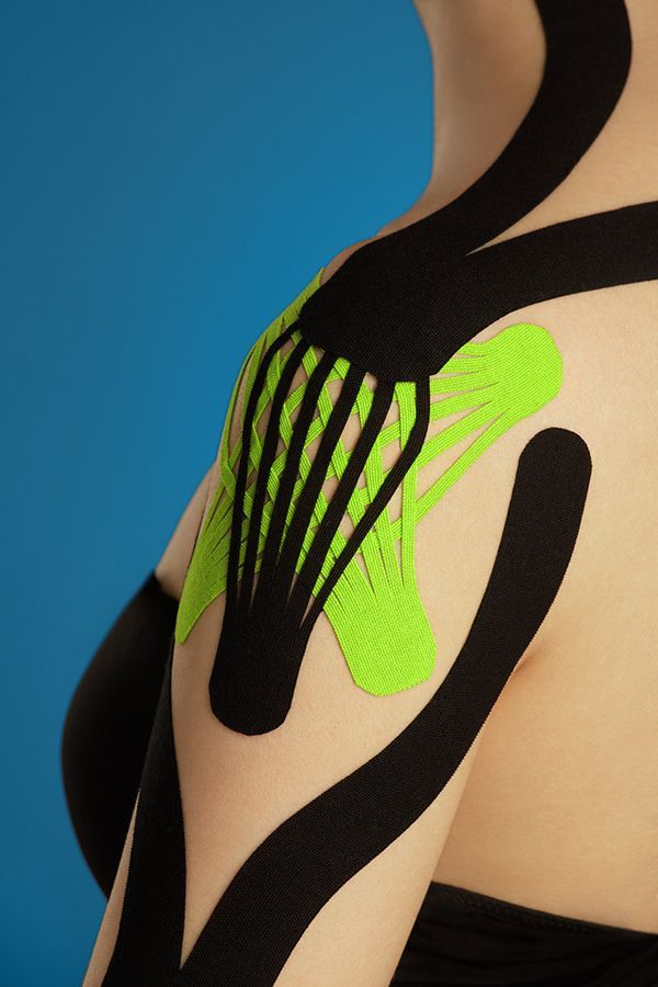 Kinesio teipimine näide 2